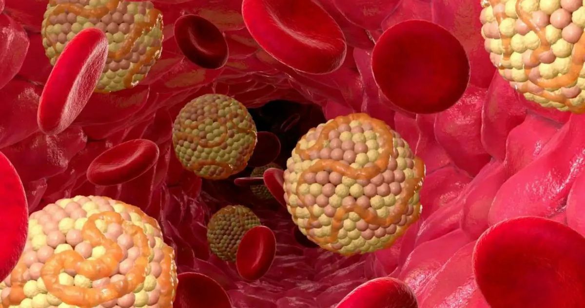 Зеркало как индикатор здоровья: 5 признаков, указывающих на проблемы с холестерином